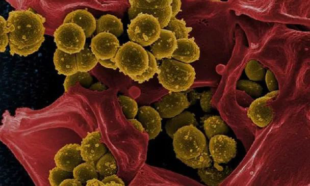 ѩùʲôʲôҪʹÿù壿